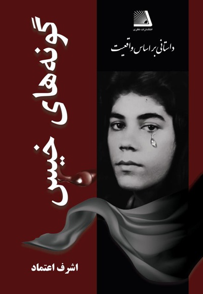گونه های خیس